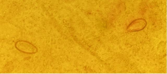 节聚餐这口“鲜”可能让它找上门!冰球突破发现多例本地感染病例春(图2) 节聚餐这口“鲜”可能让它找上门!冰球突破发现多例本地感染病例春(图2)